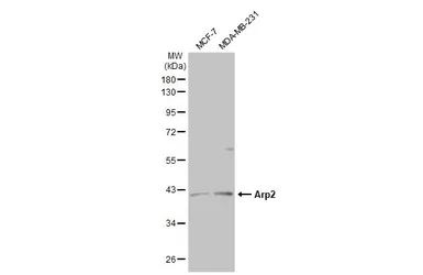 Anti-Arp2 antibody [N1C3] used in Western Blot (WB). GTX103311