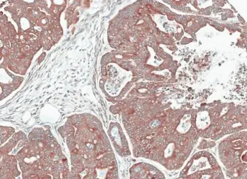 Anti-CCN3 antibody used in IHC (Paraffin sections) (IHC-P). GTX103377