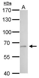 Anti-tPA antibody used in Western Blot (WB). GTX103453