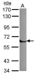 Anti-tPA antibody used in Western Blot (WB). GTX103453