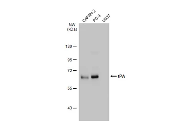 Anti-tPA antibody used in Western Blot (WB). GTX103453