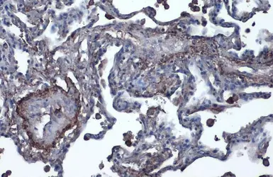 Anti-Vitronectin antibody used in IHC (Paraffin sections) (IHC-P). GTX103475