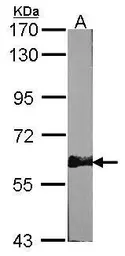 Anti-AMPK alpha 2 antibody used in Western Blot (WB). GTX103487