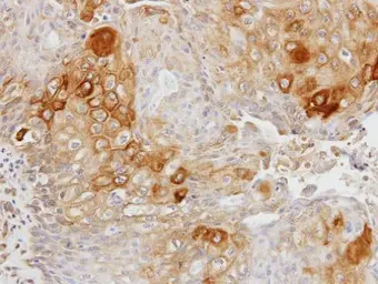 Anti-Glycerol kinase 2 antibody [N1C1] used in IHC (Paraffin sections) (IHC-P). GTX103519