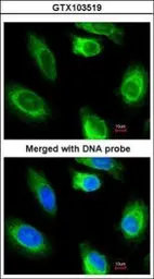 Anti-Glycerol kinase 2 antibody [N1C1] used in Immunocytochemistry/ Immunofluorescence (ICC/IF). GTX103519