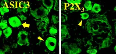 Anti-ASIC3 antibody used in Immunohistochemistry (IHC). GTX10354
