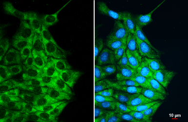 Anti-Desmin antibody used in Immunocytochemistry/ Immunofluorescence (ICC/IF). GTX103557