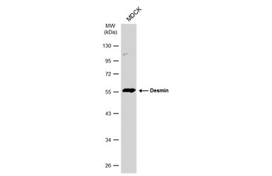 Anti-Desmin antibody used in Western Blot (WB). GTX103557