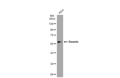 Anti-Desmin antibody used in Western Blot (WB). GTX103557