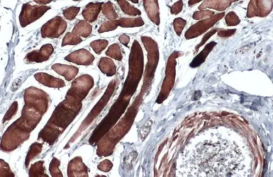 Anti-Desmin antibody used in IHC (Paraffin sections) (IHC-P). GTX103557