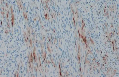 Anti-Desmin antibody used in IHC (Paraffin sections) (IHC-P). GTX103557