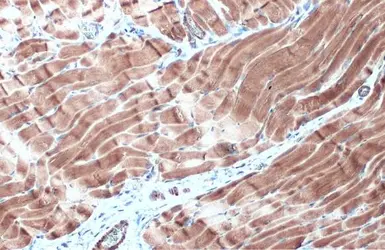Anti-Desmin antibody used in IHC (Paraffin sections) (IHC-P). GTX103557