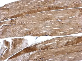 Anti-Desmin antibody used in IHC (Paraffin sections) (IHC-P). GTX103557