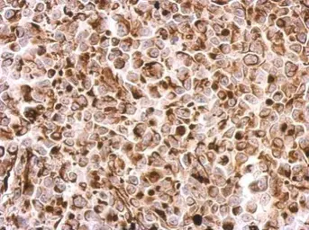 Anti-Desmin antibody used in IHC (Paraffin sections) (IHC-P). GTX103557