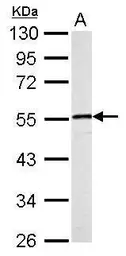 Anti-Desmin antibody used in Western Blot (WB). GTX103557