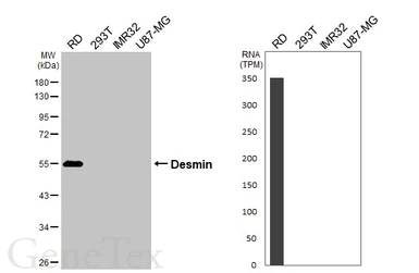 Anti-Desmin antibody used in Western Blot (WB). GTX103557