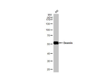 Anti-Desmin antibody used in Western Blot (WB). GTX103557