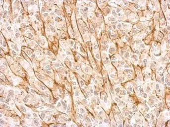 Anti-NMDAR2A antibody used in IHC (Paraffin sections) (IHC-P). GTX103558