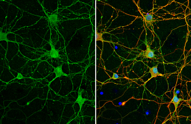 Anti-NMDAR2A antibody used in Immunocytochemistry/ Immunofluorescence (ICC/IF). GTX103558