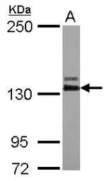 Anti-ABL2 antibody [N1N3] used in Western Blot (WB). GTX103584
