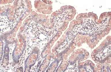 Anti-CYR61 antibody [N1C3] used in IHC (Paraffin sections) (IHC-P). GTX103669