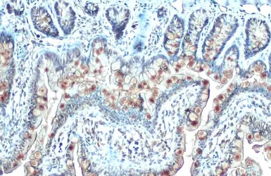 Anti-CYR61 antibody [N1C3] used in IHC (Paraffin sections) (IHC-P). GTX103669