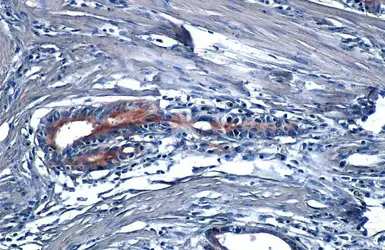 Anti-CYR61 antibody [N1C3] used in IHC (Paraffin sections) (IHC-P). GTX103669