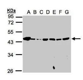 Anti-MPI antibody used in Western Blot (WB). GTX103682