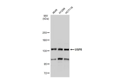 Anti-USP8 antibody used in Western Blot (WB). GTX103747