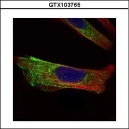 Anti-Cytokeratin 17 antibody used in Immunocytochemistry/ Immunofluorescence (ICC/IF). GTX103765