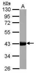 Anti-Cytokeratin 17 antibody used in Western Blot (WB). GTX103765