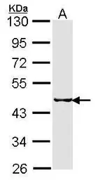 Anti-SEPHS2 antibody used in Western Blot (WB). GTX103766