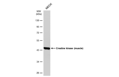 Anti-Creatine kinase (muscle) antibody [N1C3] used in Western Blot (WB). GTX103792