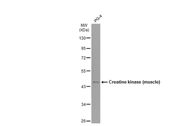 Anti-Creatine kinase (muscle) antibody [N1C3] used in Western Blot (WB). GTX103792