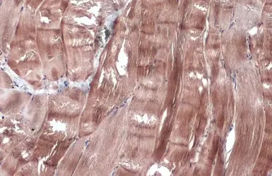 Anti-Creatine kinase (muscle) antibody [N1C3] used in IHC (Paraffin sections) (IHC-P). GTX103792