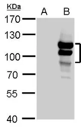 Anti-L3MBTL1 antibody used in Western Blot (WB). GTX103793