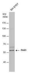 Anti-PAK1 antibody used in Western Blot (WB). GTX103797