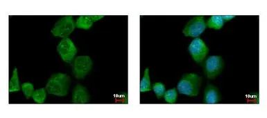 Anti-PAK1 antibody used in Immunocytochemistry/ Immunofluorescence (ICC/IF). GTX103797