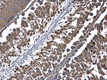 Anti-HSD17B4 antibody used in IHC (Paraffin sections) (IHC-P). GTX103864