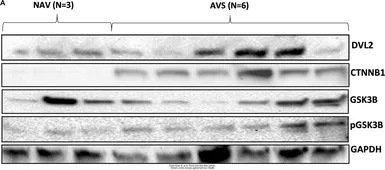 Anti-Dishevelled 2 antibody [N2C2], Internal used in Western Blot (WB). GTX103878