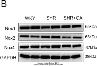 Anti-NOX1 antibody used in Western Blot (WB). GTX103888