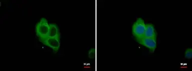 Anti-NOX1 antibody used in Immunocytochemistry/ Immunofluorescence (ICC/IF). GTX103888