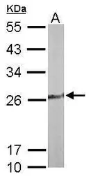 Anti-TPK1 antibody used in Western Blot (WB). GTX103943