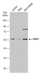 Anti-IP6K1 antibody used in Western Blot (WB). GTX103949