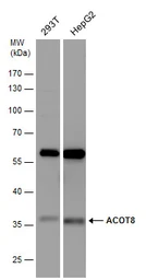 Anti-ACOT8 antibody [N1C3] used in Western Blot (WB). GTX103960