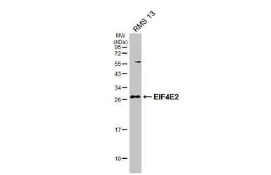 Anti-EIF4E2 antibody [N1C3] used in Western Blot (WB). GTX103977