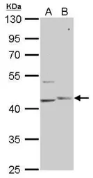 Anti-PHKG1 antibody [N1C3] used in Western Blot (WB). GTX104019