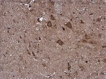 Anti-Pyruvate Dehydrogenase E1 beta subunit antibody used in IHC (Paraffin sections) (IHC-P). GTX104040