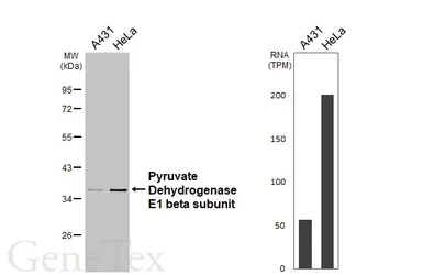 Anti-Pyruvate Dehydrogenase E1 beta subunit antibody used in Western Blot (WB). GTX104040