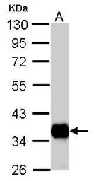 Anti-Pyruvate Dehydrogenase E1 beta subunit antibody used in Western Blot (WB). GTX104040